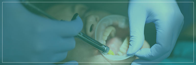 tooth-extrortATION